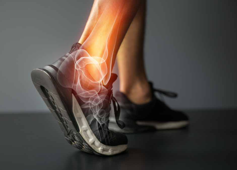 How to manage an ankle sprain