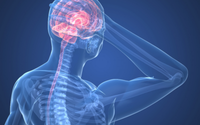 Headaches: Can Physio Help?
