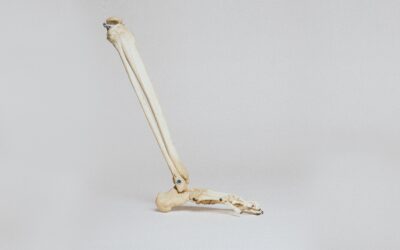 Healthy Bones – What you need to know