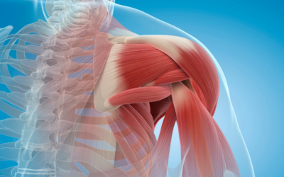 Shoulder Impingement: How can we help you in 2023?