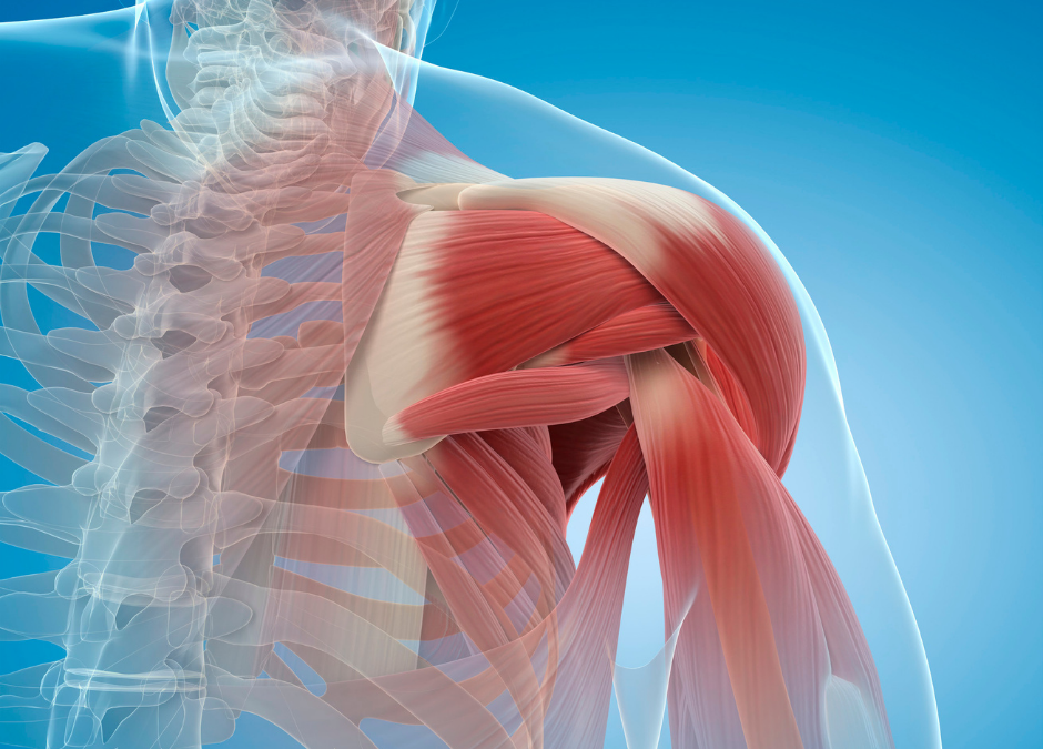 Shoulder Impingement: How can we help you in 2023?