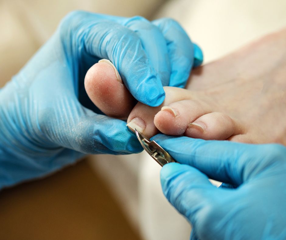 chiropody nail chiropody nail